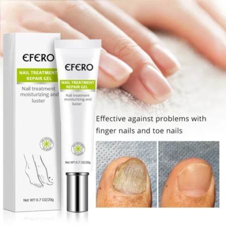 Fungal Nail Treatment Serum