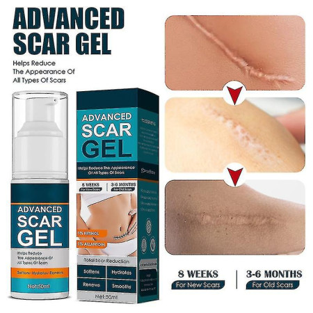 Jaysuing Remover Scar Removal Stretch Marks Relief And Burns Acne Mark Removal